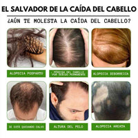 TONICO CAPILAR-TRATAMIENTO